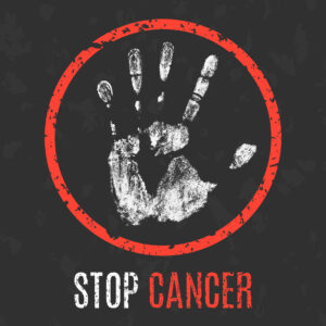 A red circle with a white hand print with the words Stop Cancer. Cancer treatment
