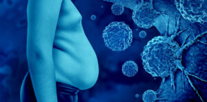 Obesity And Cancer as malignant tumor cells in an overweight human body linked to increased risk of certain cancers due to genetics or lifestyle choices oncology