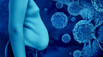 Obesity And Cancer as malignant tumor cells in an overweight human body linked to increased risk of certain cancers due to genetics or lifestyle choices oncology