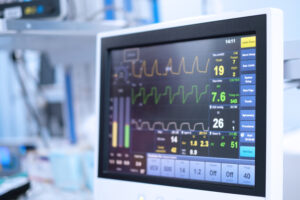 the screen of ventilator monitoring in operating room