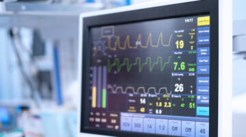 the screen of ventilator monitoring in operating room