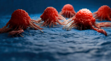 Cancer cell view - 3d rendered image, enhanced scanning electron micrograph (SEM) of cancer cell. Visual of overall shape of the cell's surface at a very high magnification. Medical research concept.