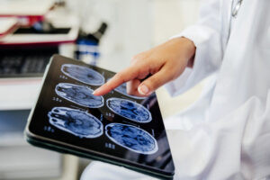 A close-up view of a doctor's hand pointing at brain scan images displayed on a digital tablet. This image captures a moment of medical analysis, highlighting the use of digital technology for detailed examination of patient's health diagnostics.