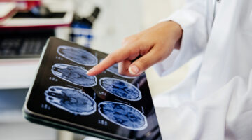 A close-up view of a doctor's hand pointing at brain scan images displayed on a digital tablet. This image captures a moment of medical analysis, highlighting the use of digital technology for detailed examination of patient's health diagnostics.