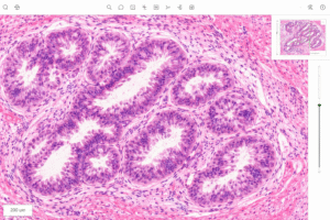 Microscopic view of glandular tissue